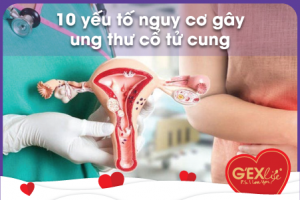 10 yếu tố nguy cơ gây ung thư cổ tử cung